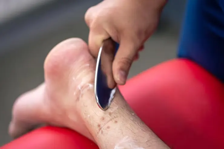 Physical therapist performing iastm with a patient